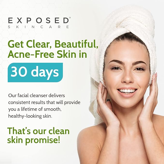 Exposed Skin Care Acne Facial Cleanser - Gentle Face Wash with Salicylic Acid for Acne Prone Skin - Pore Clarifying Acne Treatment for All Ages, Skin Types