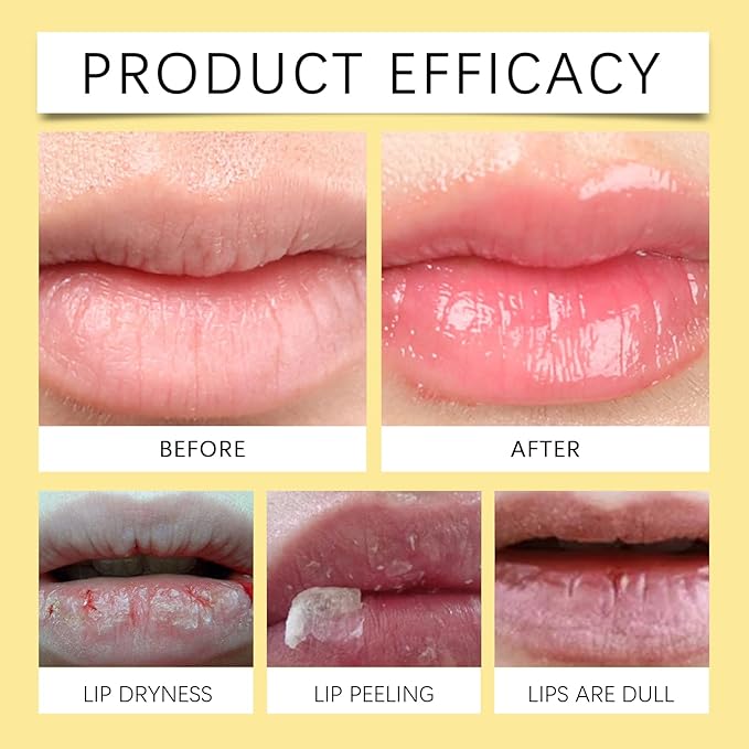Honey Lip Balm, Propolis Long Lasting Hydrating Lip Butter & Mask, Overnight Nourishing Care, Gentle Exfoliation, Non-sticky Fresh Texture
