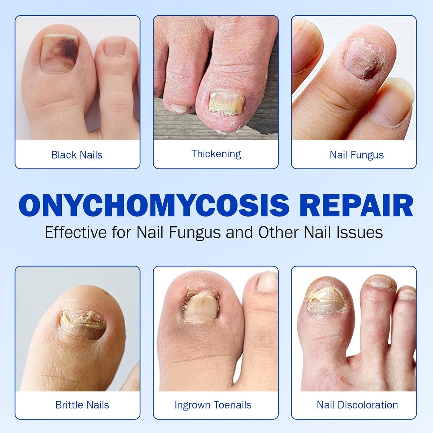21 PCS Nail Patches ,Toenail Treatment Patch Extra Strength 8-Hour ,Nail Repair Patches,Nail Repair for Restores Damaged Nails and Appearance of Discolored,Overnight Renewal for Men and Women