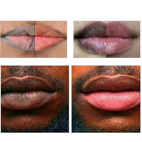 2PC Lip Balm Fade Dark Pigment Whitening Moisturizing Lip Hyaluronic Acid Exfoliating Dead Skin Lightening Lip Care (Yellow)