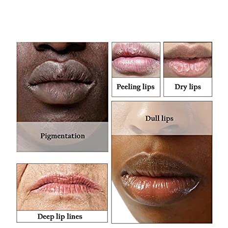 2pcs Lip Lightening for Dark Lips Lip Brightener for Smokers Dark Lip Treatment Lightening Cream for Pink Lips Lip Lightener for Smoker Lips Lip Lightening balm for Men and Women (Green)
