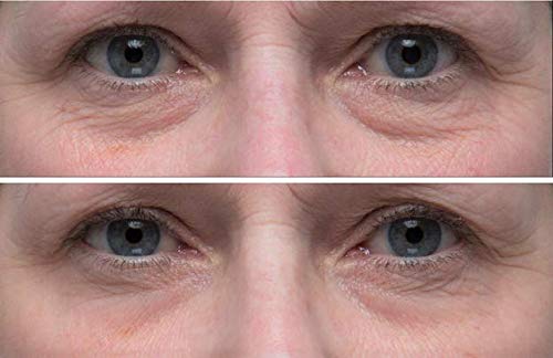 Dr. Denese SkinScience HydroShield Eye Emulsion Increased Hydration with Botanical Stem Cells, Sodium PCA, Watermelon Extract, Ceramides & Amino Acids - Improve the Look of Lines & Wrinkles - 1oz