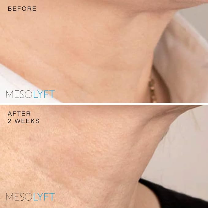 Neck & Eyes Combo Skincare Tool under Eye Serum With Neck Line Remover Neck and Décolletage Beuty Tool & Under Eye Wrinkle Filler Exfoliates the Skin, Visibly Firm & Smooth Necklines