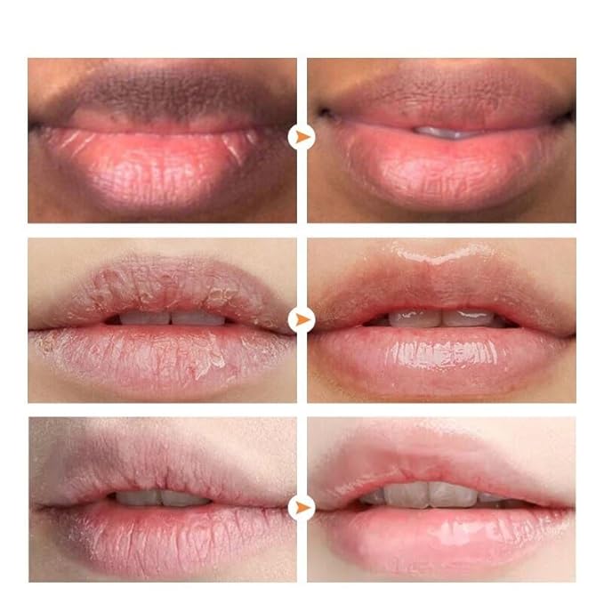 2pcs Lip Lightening for Dark Lips Lip Brightener for Smokers Dark Lip Treatment Lightening Cream for Pink Lips Lip Lightener for Smoker Lips Lip Lightening balm for Men and Women (Yellow)