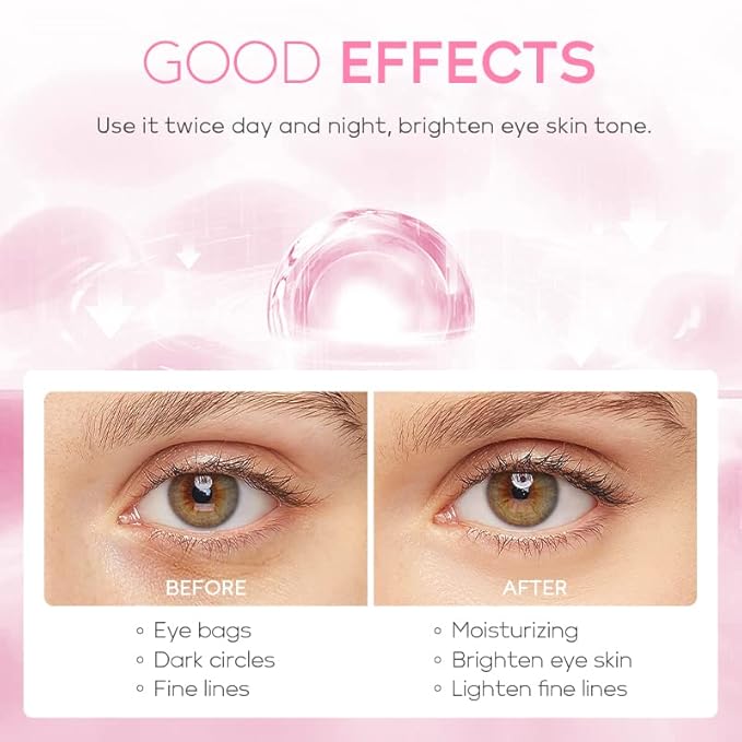 AKARY Cherry Blossom Eye Cream with Hyaluronic Acid, Lightweight Skincare Eye Cream for Dark Circles and Puffiness, Hydrating Under Eye Cream for All Skin Types, Cruelty-Free & Fragrance-Free