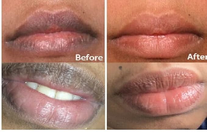 2PC Lip Balm Fade Dark Pigment Whitening Moisturizing Lip Hyaluronic Acid Exfoliating Dead Skin Lightening Lip Care (Red)
