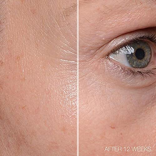 MD Complete Total Eye Treatment | Anti-Aging Hydrating Skin Renewal Eye Treatment | with Peptides, Vitamins C & E and Hyaluronic Acid for Wrinkles, Fine Lines and Crows Feet 0.5 fl oz