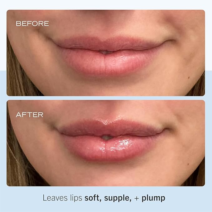 First Aid Beauty Ultra Repair Lip Balm – Instantly Hydrates to Leave Lips Soft, Supple + Plump – Concentrated Formula of Botanical Oils, Butters + Waxes – 0.25 oz