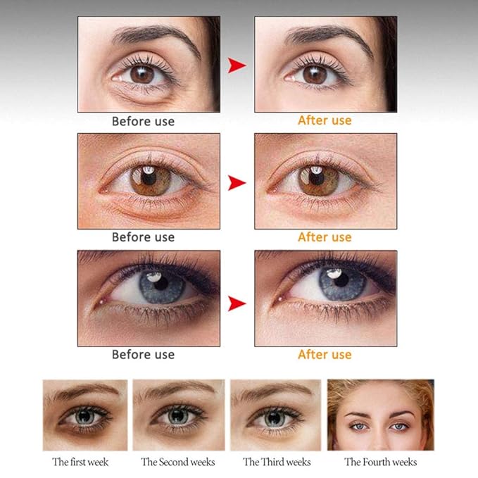 Eye Peptide Serum Eye Massage Roller Nourishing Relieve Loose Eye Bags Dark Circles Eye Skin Care Under Eye Cream for Fine Wrinkles and Puffiness Daily Skincare(Nourishing Grey)
