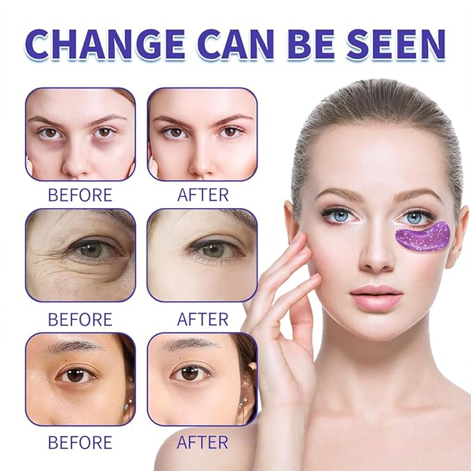 28 Pairs Under Eye Patches, Natural Collagen Eye Patches for Puffy Eyes, Under Eye Mask Patches for Face, Reduce Dark Circles, Fine Lines and Puffiness, Refreshes Your Skin, Eye Moisturizer Treatment