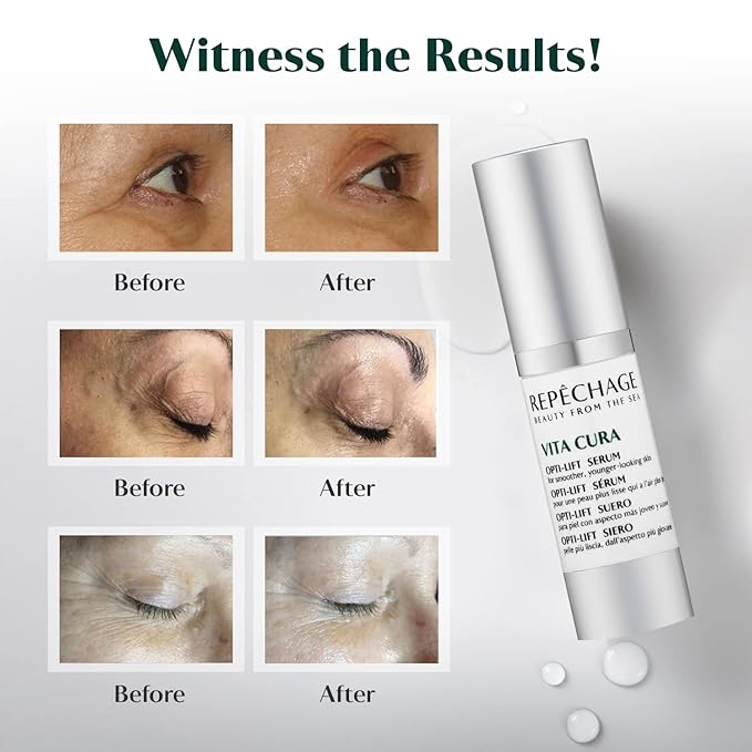 Repechage Vita Cura Opti-Lift Serum - Anti Aging Eye Contour Lifting Effect to Smooth Out Look of Wrinkles and Crow's Feet with Almond Protein, Seaweed Extracts, and Peptides, 15ml /0.5fl oz.