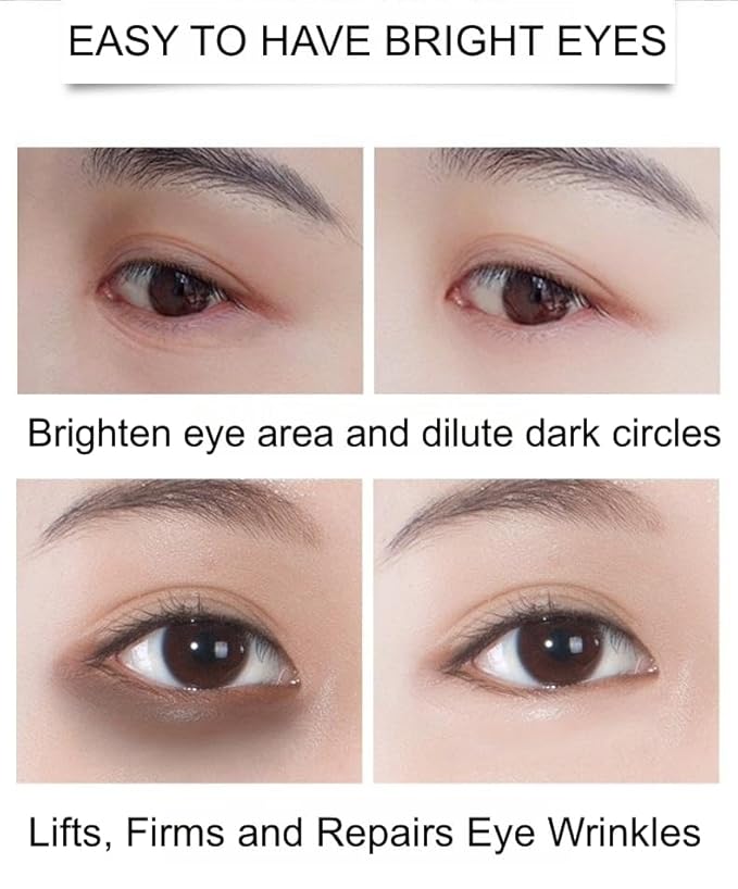 Under Eye Patches - 24K Gold Eye Mask,Moisturizing Serum for Firming, Brightening, and Relieving Eye Fatigue - Under Eye Patches for Dark Circles and Puffiness (gold)