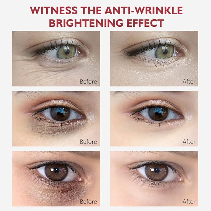 Retinol Eye Cream, Anti-Aging with Vitamin C & Ceramide for Dark Circles, Wrinkles & Fine Lines, Crow’s Feet, 0.7 fl.oz