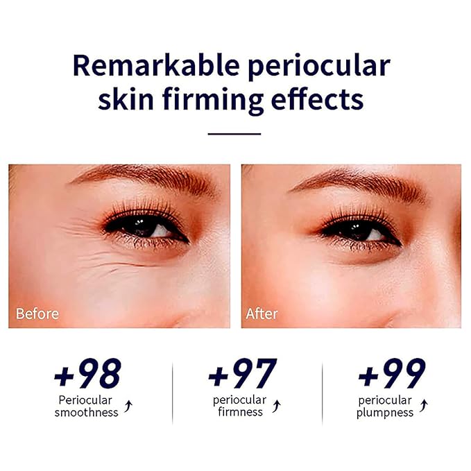 Snail Peptide Advanced Under Eye Cream for Dark Circles, with 360° Massage Ball Reduces Wrinkles &Fine Lines, Eye Essence Roll-On, Firms, Moisturizes, and Tightens Puffy Eyes for Men&Women