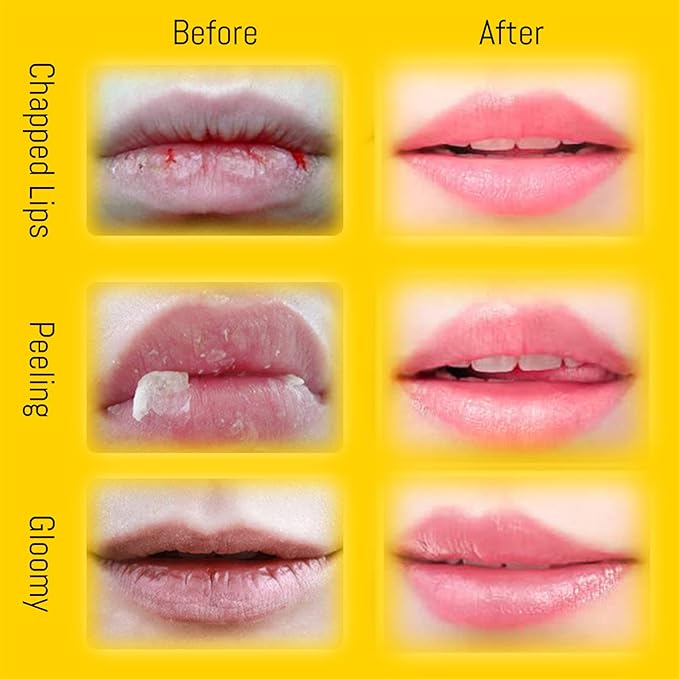 2PCS Bee Lip Balm Honey Pot, Honey Pot Lip Balm for Dry Cracked Lips, Strawberry Lip Balm Scrubs Exfoliator & Moisturizer, Hydrating Lip Balm Honey Pot with Wand, Lip Sleeping Mask (A)