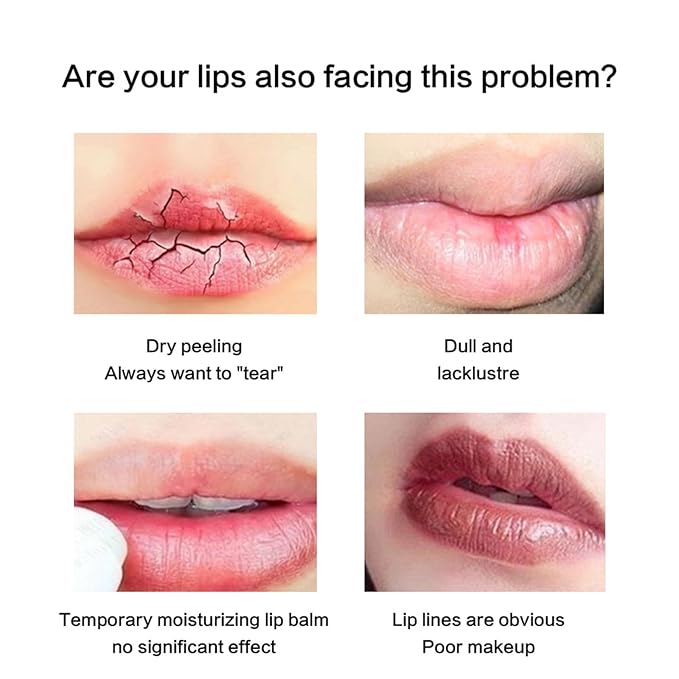 Lip Collagen Plumper Moisturizing Lip Repairing Sleeping Mask with Squalane Fade Lip Lines Hydrating Lip Treatment for Remove Dead Skin Beauty Care