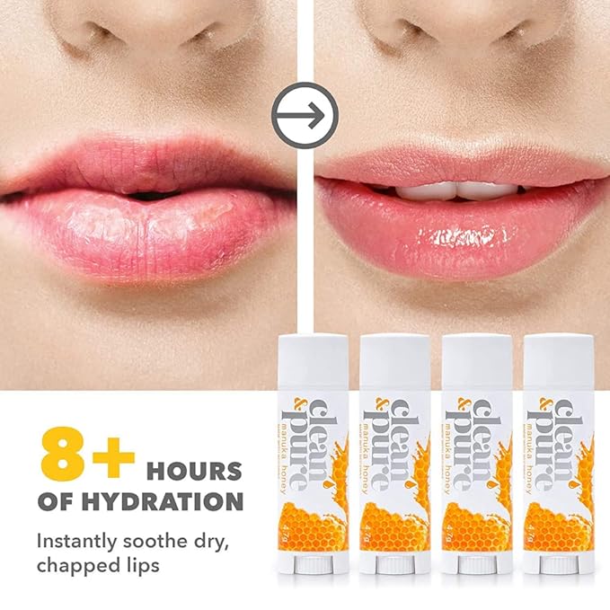 Lip Balm 3-Pack (Manuka Honey) | Lip Care Set With 100% All Natural Beeswax and Vitamin E Oil | Flavored Lip Balm for Dry, Chapped Lips | Made in Australia…