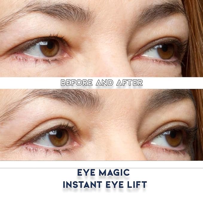 Eye Magic Premium Eye Lift (S/M Kit + Gel) Made in America Instantly Lifts and Defines Droopy, Sagging or Hooded Eyes Safe For Daily Use