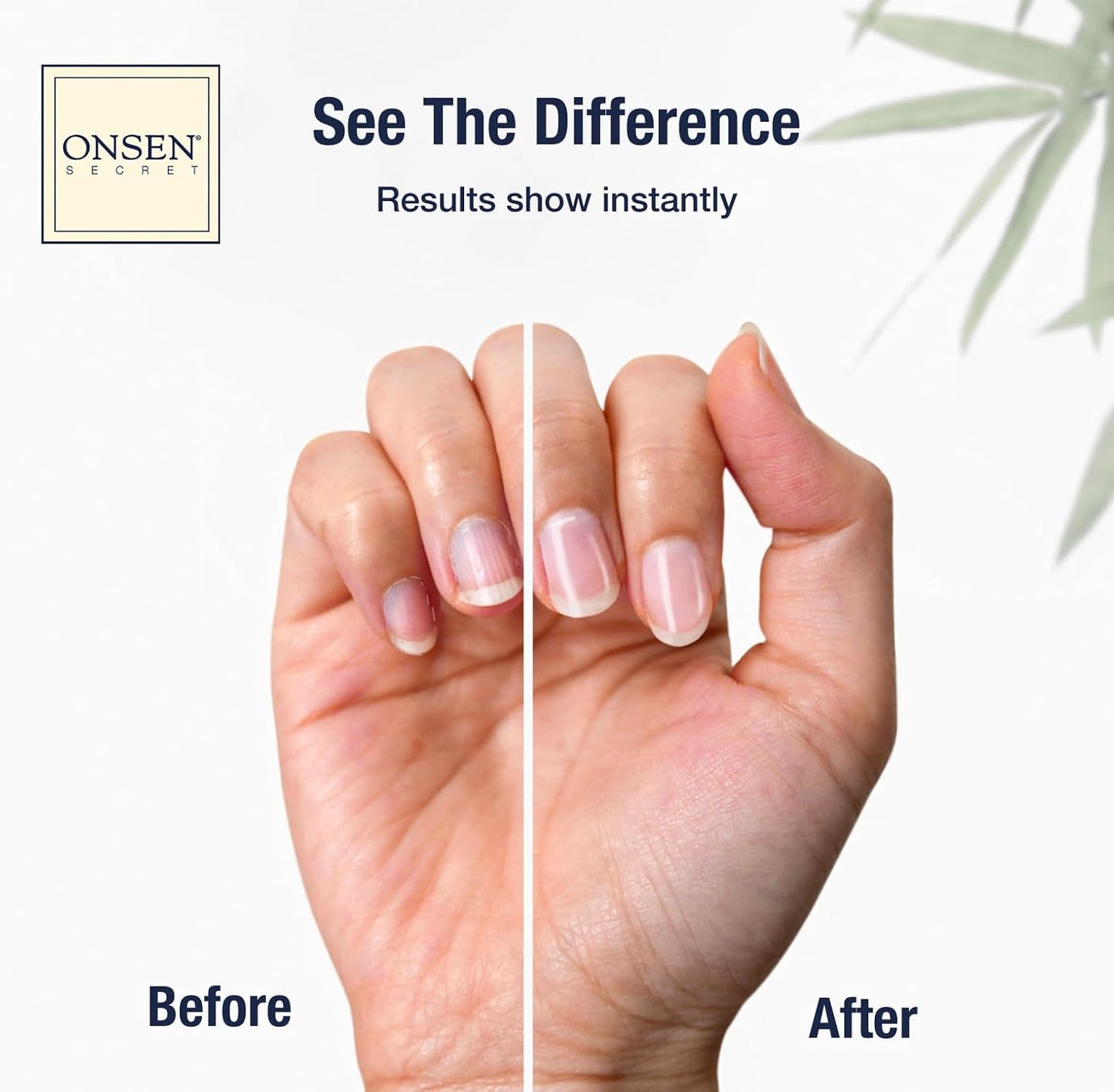 Onsen Nail & Cuticle Cream Treatment w/Japanese Tsubaki, Jojoba & Lavender Oil, Shea Butter - Strengthens Nails, Softens Cuticles - Daily Repair Care (1 Count/30 ml)