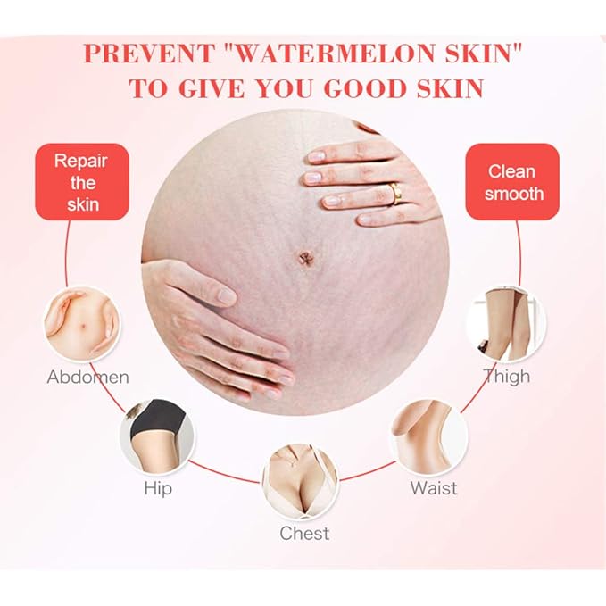 AICHUN BEAUTY Pregnancy Cream Streach Mark Remover Scars Repair Cellulites Lotion Cream 150ml