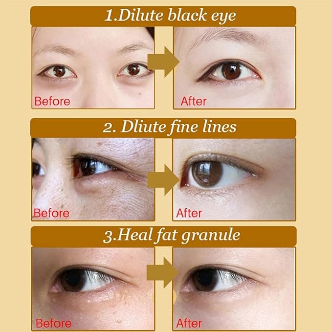 24K Gold Crystal Collagen Under Eye Mask, Anti Aging Hyaluronic Acid Under Eye Patches for Moisturizing & Reducing Dark Circles (15 Pairs)