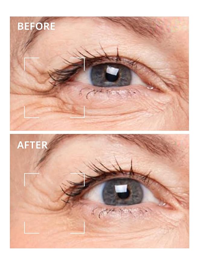 depology Deepcare+ Serum-Infused Micro Dart Patche | 4 Pairs Eye Mask | Under Eye Patches for Wrinkles | Fine Lines | Hydrating Eye Mask with Peptides | Amino Acids | and Synthesized Molecules