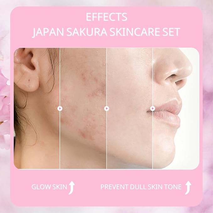 Sakura Skin Care Set, Women Gift Sets, Skin Care Kit with Cleanser, Toner, Serum, Eye Cream, Face Cream, Skin Care Routine Kit for Women, Even Skin Tone, Tighten & Firm Skin
