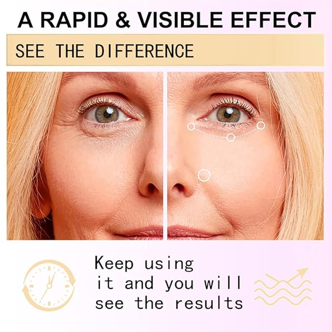 Snail Peptide Eye Cream Non-Sticky Snail Mucin Eye Care Hydrating Essence with 360° Massage Ball for Reducing Dark Circles/Puffiness/Fine Lines, Moisturizing, Firming, Adding Skin Elasticity