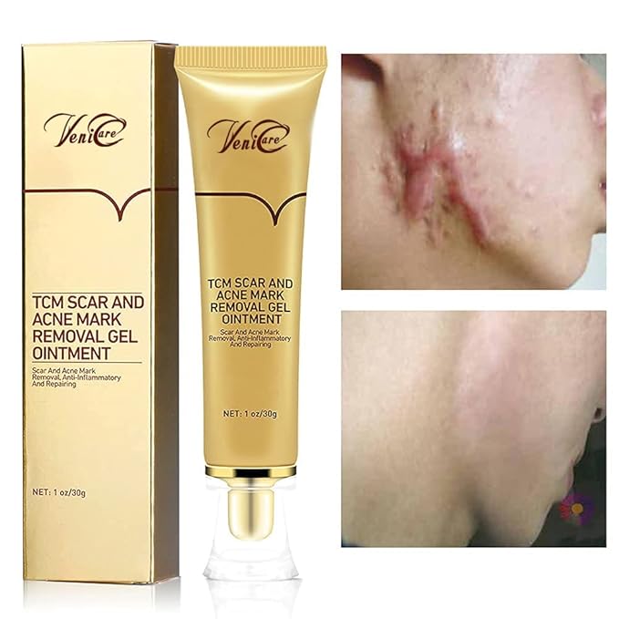 Acne Scar Removal Cream Stretch Marks Face Skin Cream Shrink Pores Gel-Fade Scar Marks Acne Skin Care (Packaging Upgrade) VeniCare