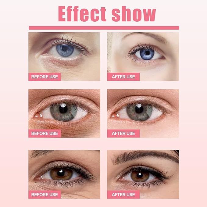 Rosehip Eye Cream Stick, Moisturizing, Hydrating, Lightens Lines and Dark Circles, Lifting, Firming