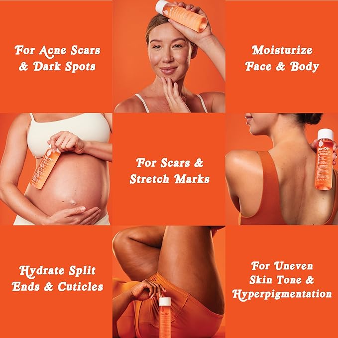 Bio-Oil Skincare Body Oil Serum, Face and Body Moisturizer with Vitamin E & A, for Scars, Stretch Marks, Sensitive Skin, All Skin Types, Dermatologist Recommended, Non-Comedogenic, 6.7 Oz