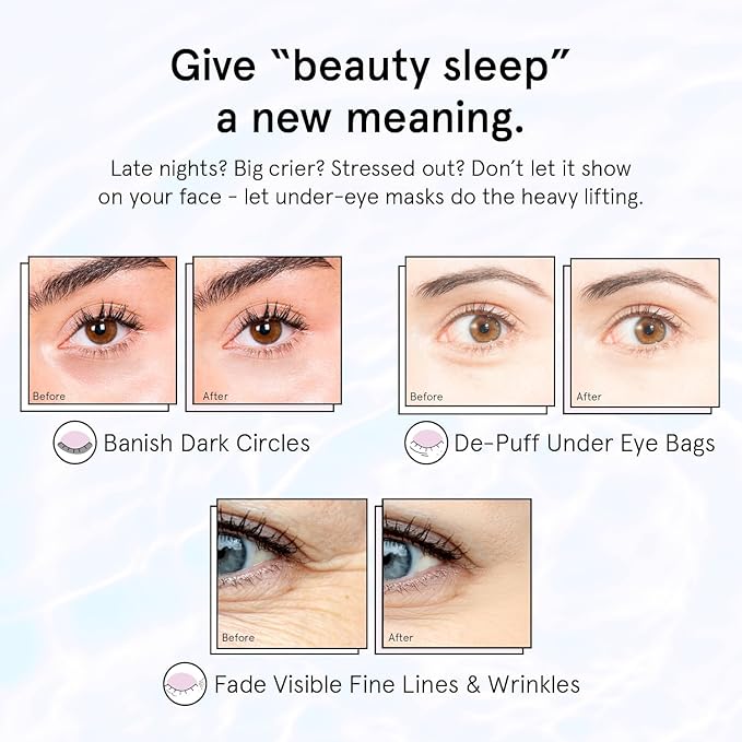 grace & stella Retinol Under Eye Patches for Puffy Eyes and Dark Circles - Restoring Gel Under Eye Masks with Hyaluronic Acid - Vegan Cruelty-Free Skincare, Birthday Gifts for Women (Purple, 24 Pairs)