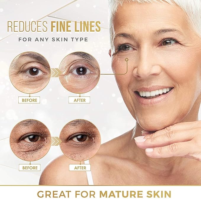 DERMORA Skin Treatment Mask 24K Gold Eye Mask - 20 Pairs Eye Gels - Rejuvenating Treatment for Dark Cirlce,Puffiness,Refresh,Revitalizing,Travel,Wrinkles