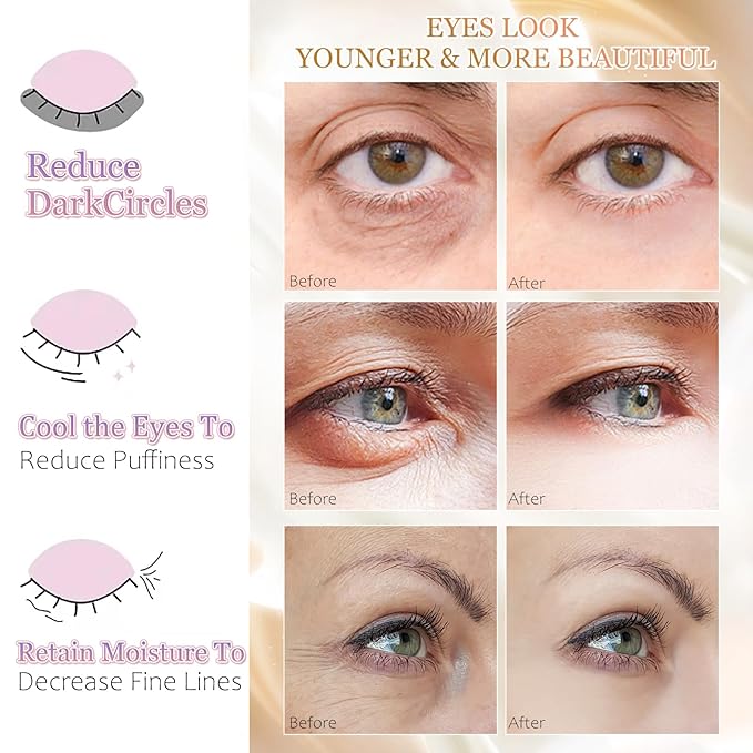 MOND'SUB Premium Under Eye Patches, Gel Eye Patches Hydrating & Refresh for Puffy Eyes, Under Eye Bags & Dark Circles, Natural Collagen Eye Gels Pads, Crystal Anti-Aging Eye Mask (Pink)