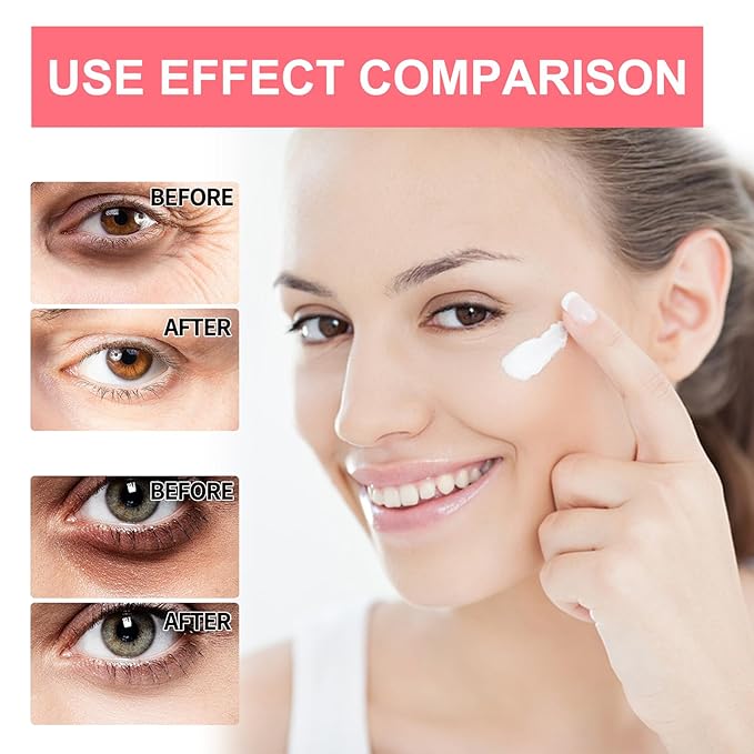 Retinol Eye Serum Stick, Retinol Eye Cream and Gel, Anti-Aging Eye Treatment