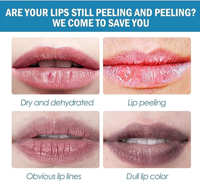 2PC Lip Balm Fade Dark Pigment Whitening Moisturizing Lip Hyaluronic Acid Exfoliating Dead Skin Lightening Lip Care (Orange)