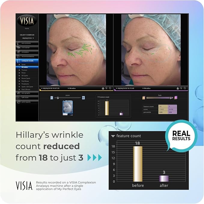 My Perfect Eyes 20ml, 200 Applications, Penny Lane, Instant Results, Clinically Proven, Anti-Ageing Serum UK Original Formula, Science-Backed Anti-Wrinkle Serum. As Seen on TV.
