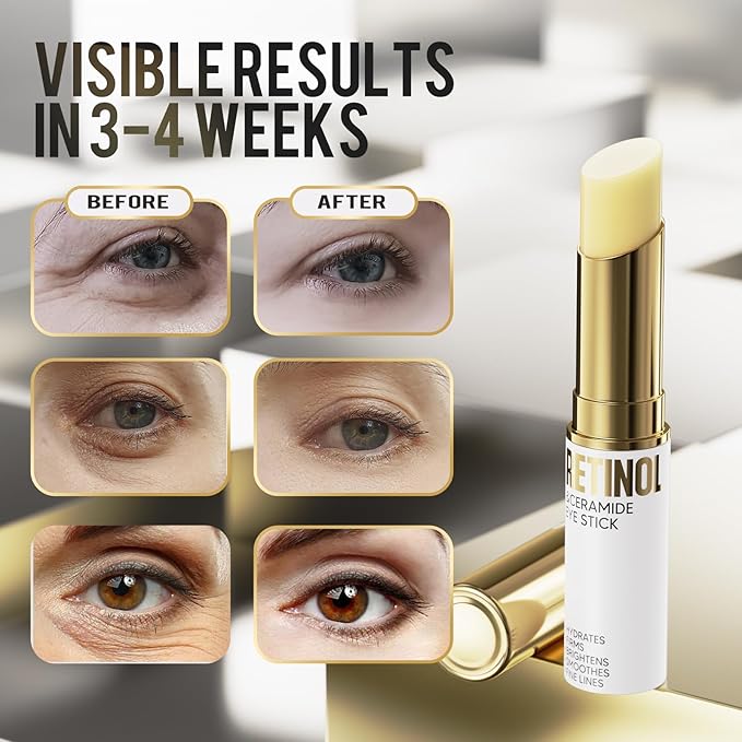 Retinol Eye Stick, Eye Cream for Dark Circles and Puffiness, Eye Brightening Cream for Hydration, Wrinkles in 3-4 Weeks, Travel Portability Anti-Aging Eye Cream for Bags Under Eye Reduces Fine Line