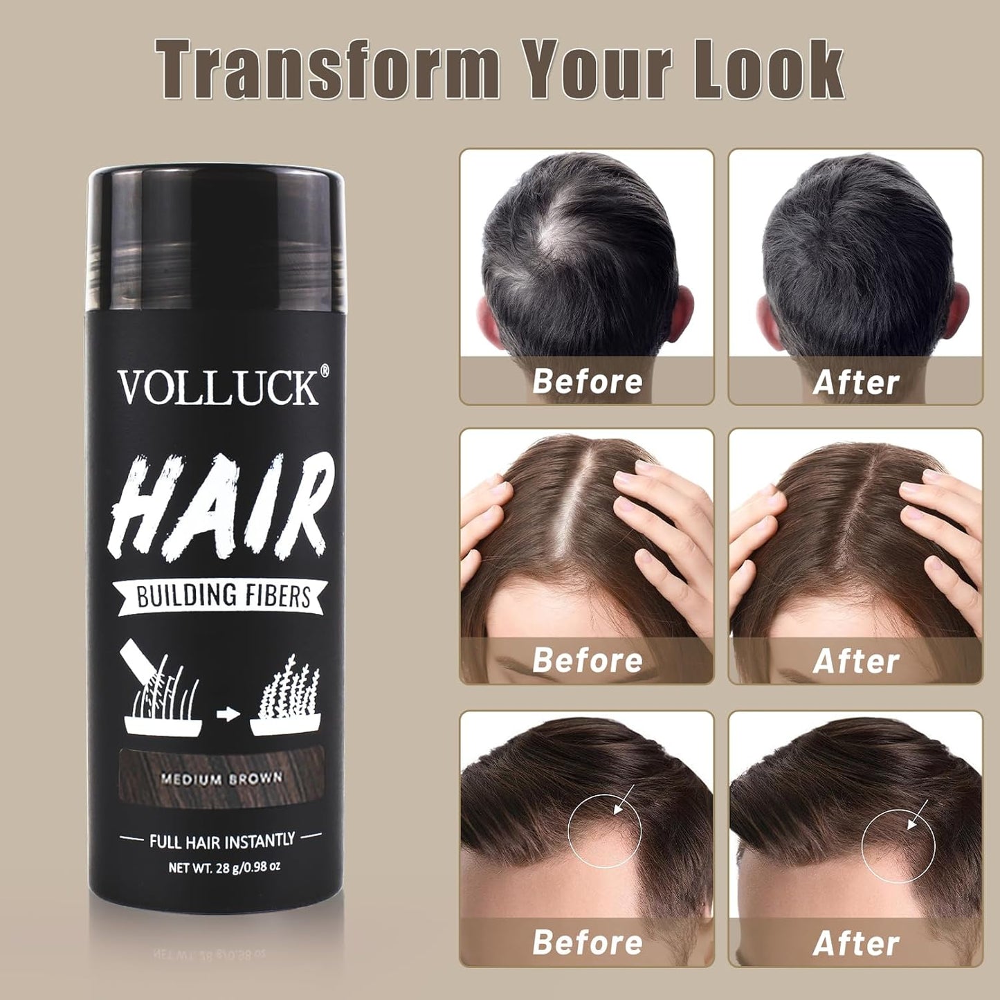 VOLLUCK Hair Fibers for Thinning Hair, Instant Coverage Hair Building Fibers for Women and men, Natural Hair Powder for Conceal Hair Loss 28 g (Medium Brown)
