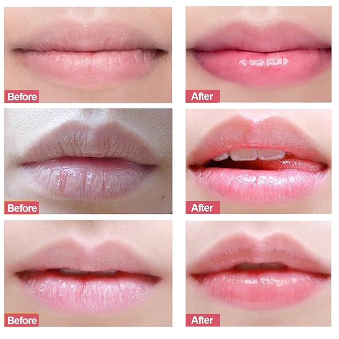 Lip Scrubs Exfoliator & Moisturizer, Lip Repair for Lush Soft Lips, Lip Moisturizer for Chapped Dry and Flaky Lips Treatment (Peach)