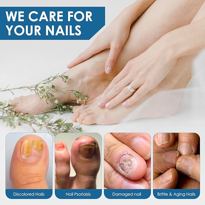 Toenail Repair Treatment, Extra Strength Nail Repair Liquid with Natural Tea Tree Oil Extract, Toenail Repair Solution for Thickened and Ingrow Nails