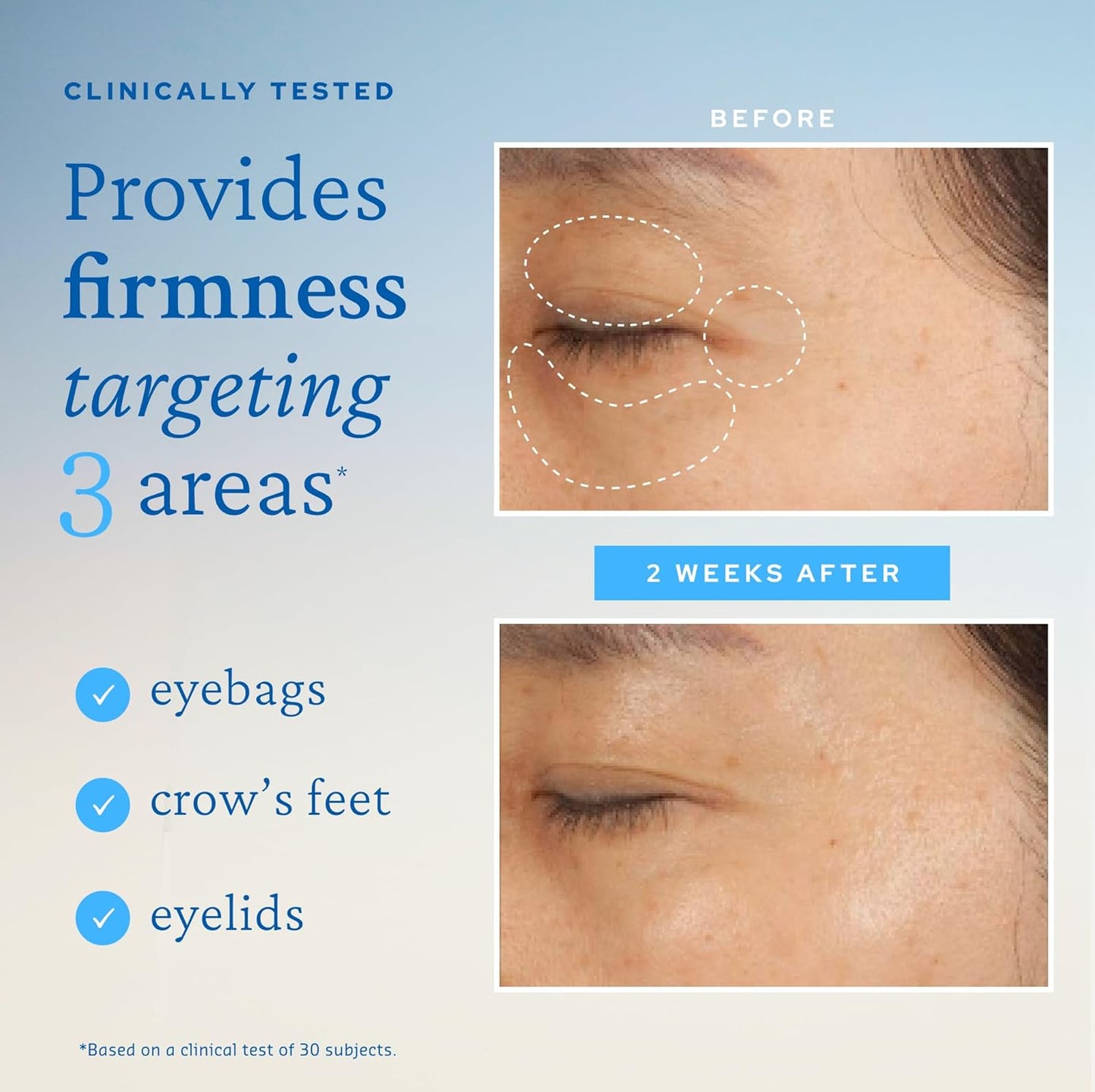 belif The True Cream Moisturizing Eye Bomb, 48hr Hydrating Eye Cream, Firms and Reduces Fine Lines and Wrinkles, Caffeine, Peptide, Ceramide, All Around The Eye Care, Korean Skin Care