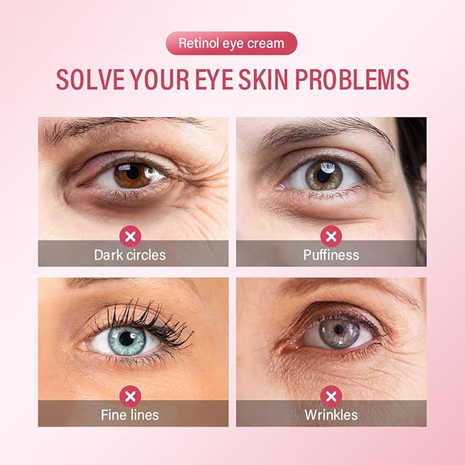 Retinol Eye Cream For Dark Circles And Puffiness, Repair Under Eye Retinol Cream with Hyaluronic Acid and Collagen, Smooth Fine Lines, Wrinkles, Bags & Dark Spots, Tightens Eye Skin Care(Retinol)