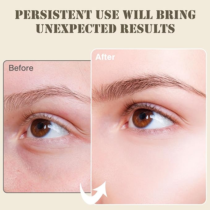 Under Eye Patches for Puffy Eyes and Dark Circles,60 Pcs Collagen Under Eye Mask Skin Care Products,Snail Mucin Eye Patches,Wrinkle Patches