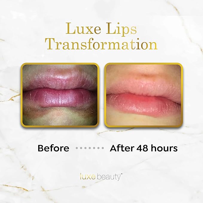 Luxe Beauty No-Beeswax, No-Petroleum Organic Lip Moisturizer for Very Dry Lips - For Sun/Wind Damage, Dryness & Chapping Lip Care – 4-Pack Hydrating Lip Care Products That Work Over/Under Lipstick