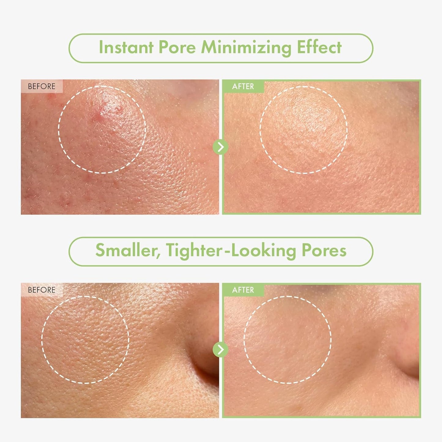 Green Caviar Pore Ampoule With 2,500ppm Green Caviar, Niacinamide, Pore Minimizer, Hydrating, Firming, Pore Tightening, Reduces Pores, Korean Skin Care, 33ml, 1.11 fl.oz.