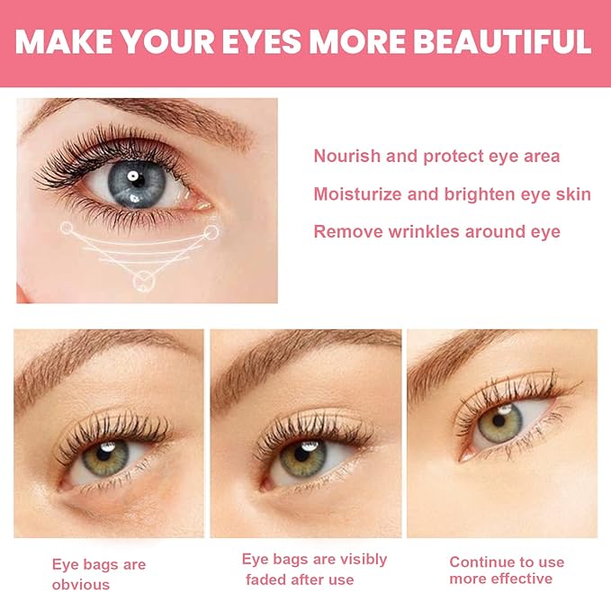 Rosehip Eye Cream Stick, Moisturizing, Hydrating, Lightens Lines and Dark Circles, Lifting, Firming