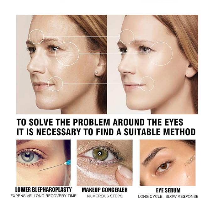 Temporary Eye Tightener Eye Cream For Puffiness And Bags Under Eyes,Instant Reduces Under-Eye Bags, Dark Circles&Puffiness, Instant Firm Eye Tightener Eye Bag Cream Anti Aging Fine Lines