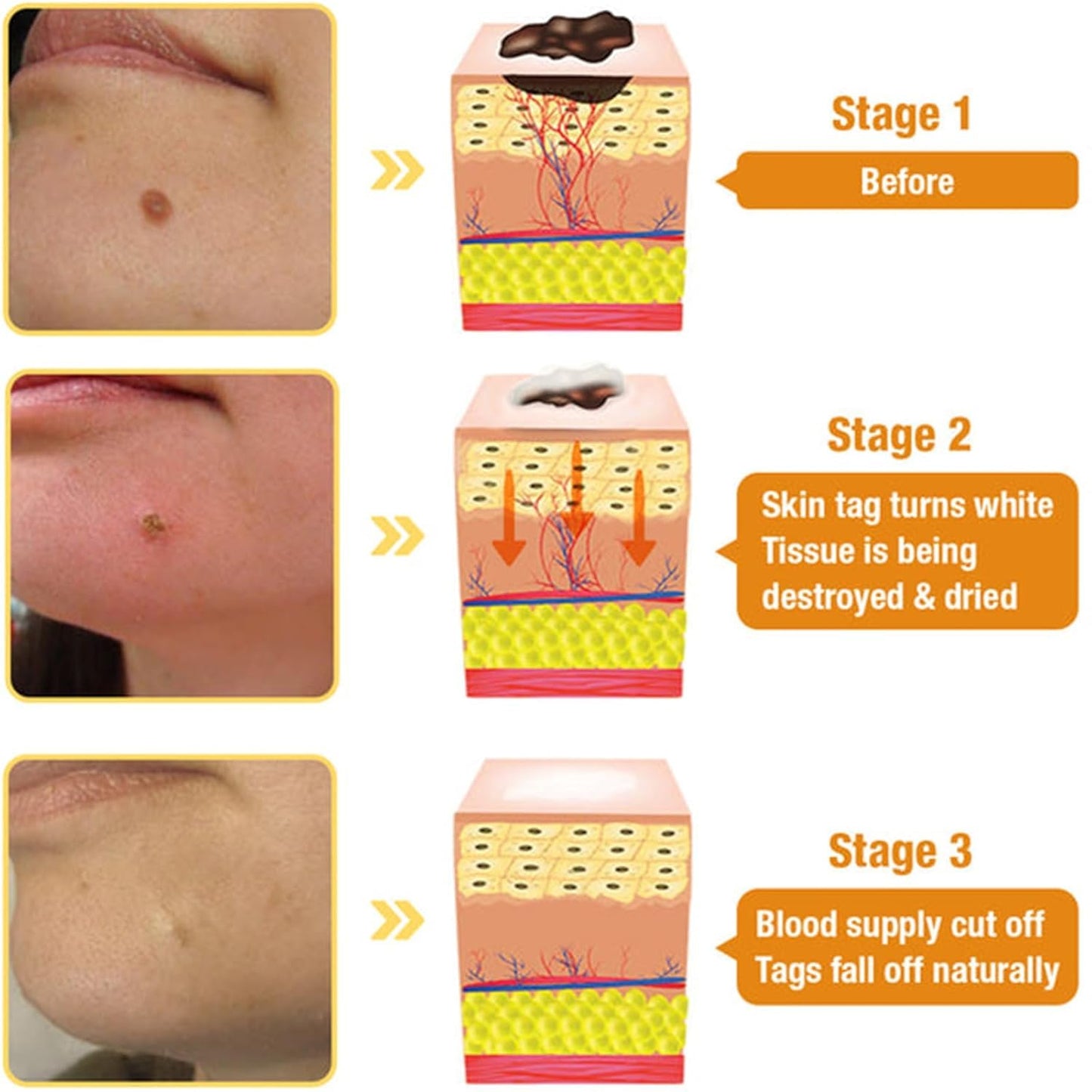 Bee Venom Comprehensive Cream, 2025 New Bee Venom Skin Treatment Cream, Firms and rejuvenates the skin, Natural Serum Suitable for All Skin Types (2)