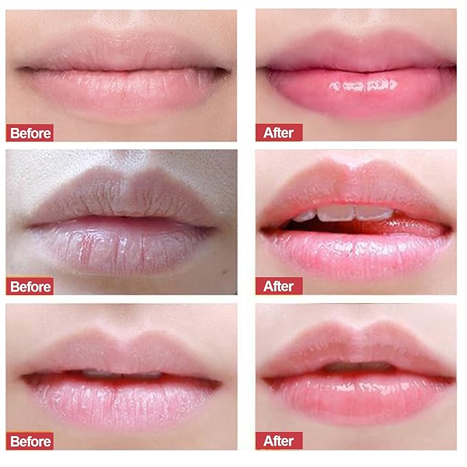 Lip Scrub, Exfoliator & Moisturizer, Lip Repair for Lush Soft Lips, Chapped Dry and Flaky Lips Treatment (Strawberry)